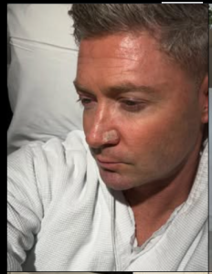 michael clarke skin cancer