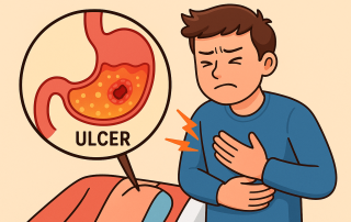 ulcer in stomach